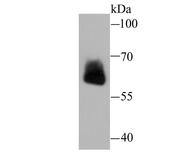 IGF2BP3 Antibody in Western Blot (WB)