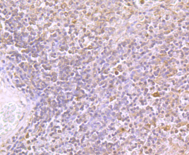 TIM-3 Antibody in Immunohistochemistry (Paraffin) (IHC (P))