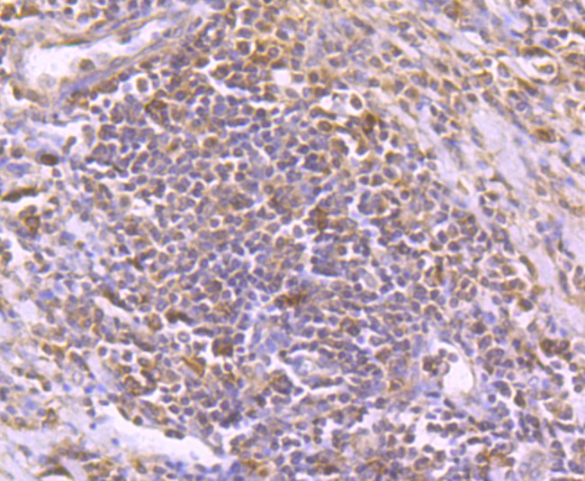 TIM-3 Antibody in Immunohistochemistry (Paraffin) (IHC (P))