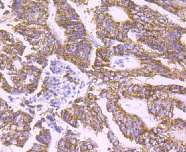 PCSK9 Antibody in Immunohistochemistry (Paraffin) (IHC (P))