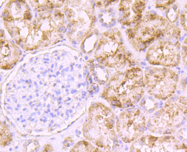 PCSK9 Antibody in Immunohistochemistry (Paraffin) (IHC (P))