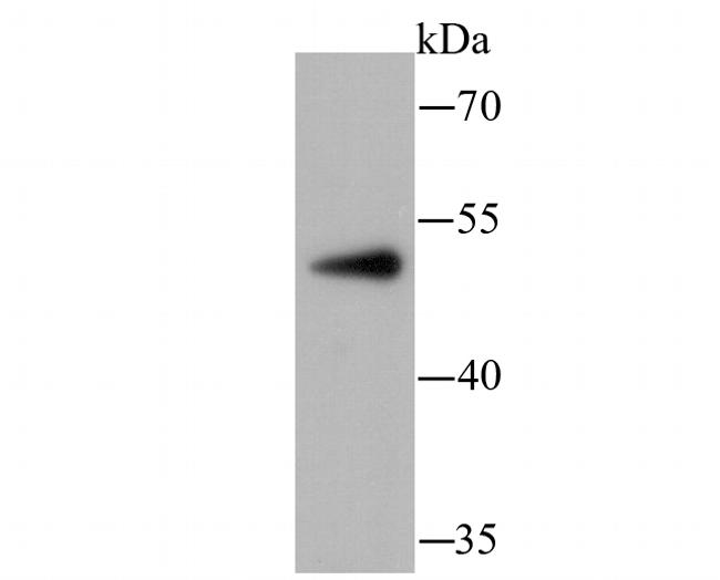 PCSK9 Antibody in Western Blot (WB)