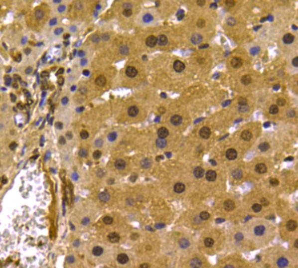 PRMT5 Antibody in Immunohistochemistry (Paraffin) (IHC (P))