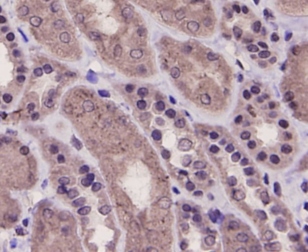 PRMT5 Antibody in Immunohistochemistry (Paraffin) (IHC (P))