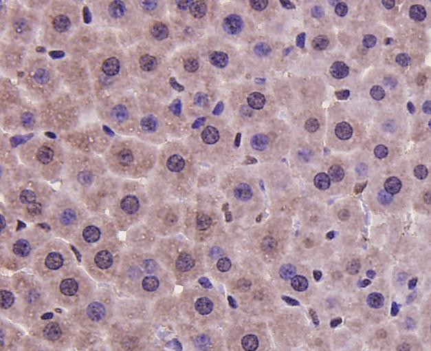 PRMT5 Antibody in Immunohistochemistry (Paraffin) (IHC (P))