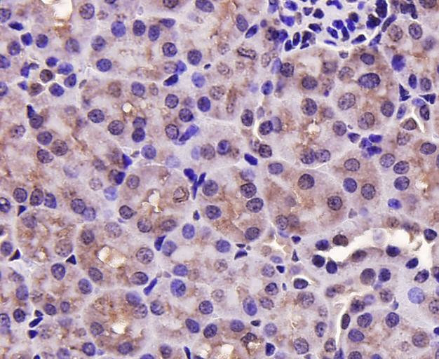 PRMT5 Antibody in Immunohistochemistry (Paraffin) (IHC (P))