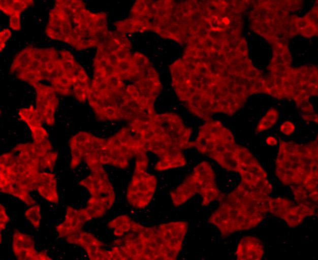 GPX1 Antibody in Immunocytochemistry (ICC/IF)