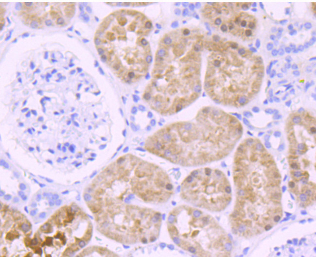 OGG1 Antibody in Immunohistochemistry (Paraffin) (IHC (P))