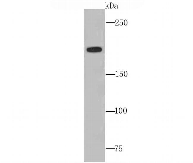 Complement C4 Antibody in Western Blot (WB)