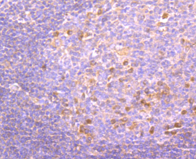 PKC beta-1 Antibody in Immunohistochemistry (Paraffin) (IHC (P))