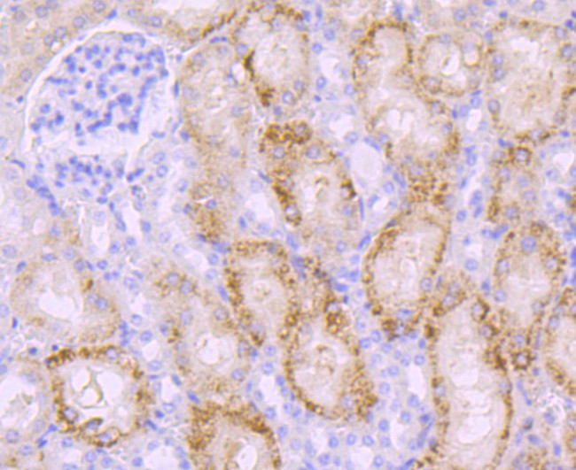 PKC beta-1 Antibody in Immunohistochemistry (Paraffin) (IHC (P))