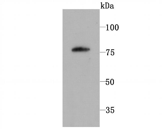 PKC beta-1 Antibody in Western Blot (WB)