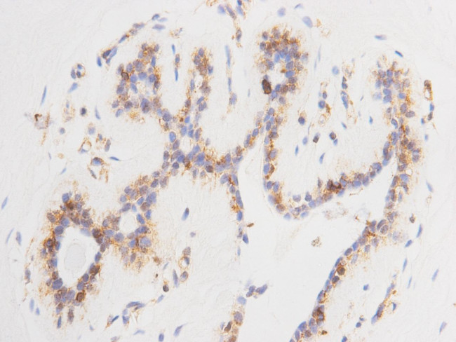 14-3-3 beta Antibody in Immunohistochemistry (Paraffin) (IHC (P))