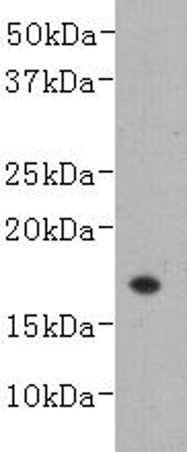 TNF beta Antibody in Western Blot (WB)