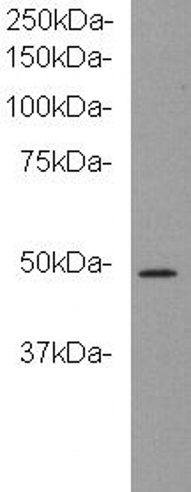 KIDINS220 Antibody in Western Blot (WB)