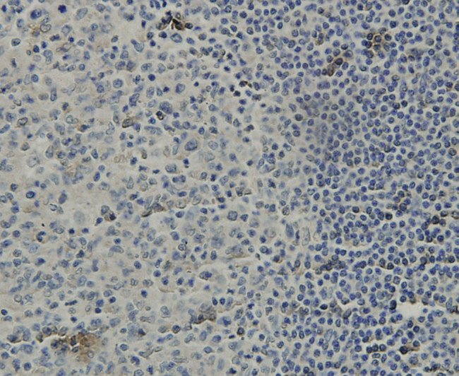 C19orf35 Antibody in Immunohistochemistry (Paraffin) (IHC (P))