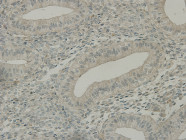 C19orf35 Antibody in Immunohistochemistry (Paraffin) (IHC (P))