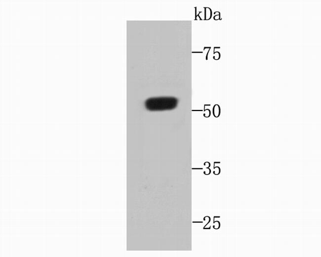 C19orf35 Antibody in Western Blot (WB)