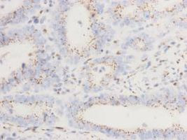 GOLGA5 Antibody in Immunohistochemistry (Paraffin) (IHC (P))