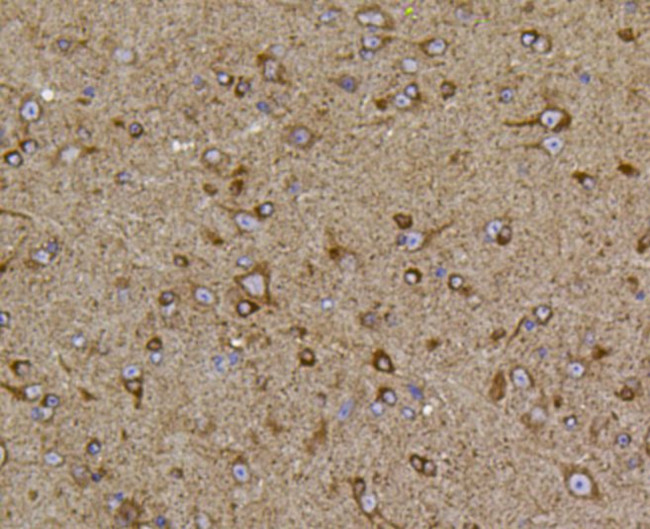 PIEZO1 Antibody in Immunohistochemistry (Paraffin) (IHC (P))