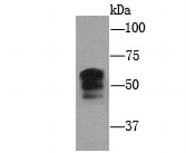 PIEZO1 Antibody in Western Blot (WB)