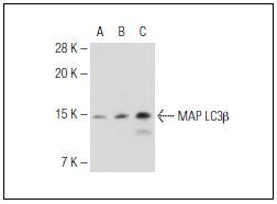 LDHA Antibody in Immunohistochemistry (Paraffin) (IHC (P))