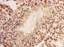 CHD1 Antibody in Immunohistochemistry (Paraffin) (IHC (P))