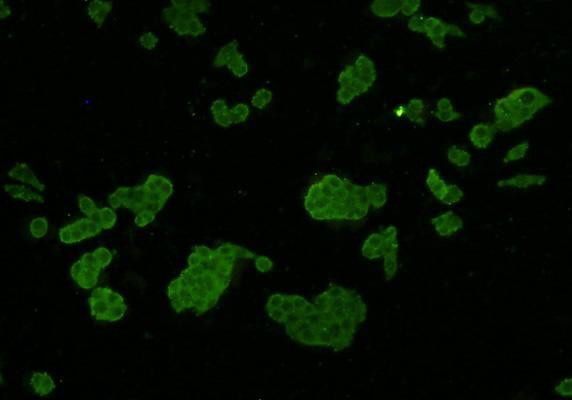 Axl Antibody in Immunocytochemistry (ICC/IF)