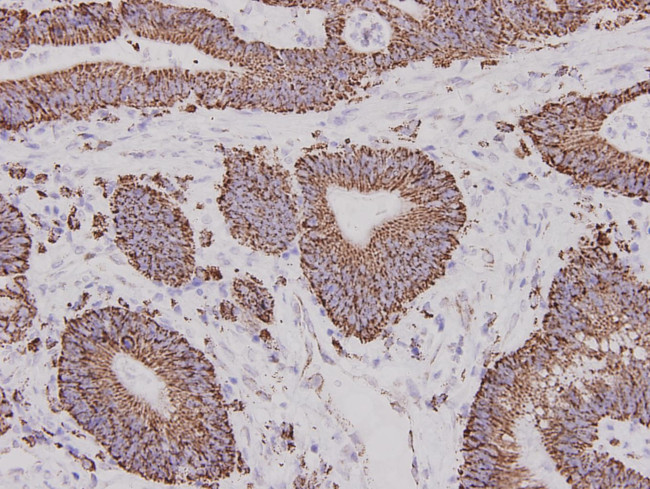 ALDH2 Antibody in Immunohistochemistry (Paraffin) (IHC (P))