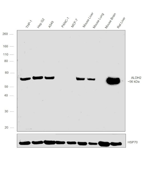 ALDH2 Antibody