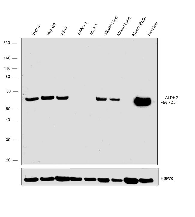 ALDH2 Antibody in Western Blot (WB)