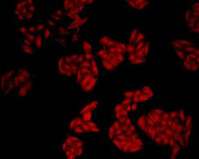 SIRT1 Antibody in Immunocytochemistry (ICC/IF)