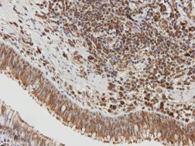 SIRT1 Antibody in Immunohistochemistry (Paraffin) (IHC (P))