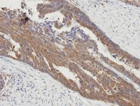 SIRT1 Antibody in Immunohistochemistry (Paraffin) (IHC (P))