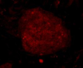 C19orf35 Antibody in Immunocytochemistry (ICC/IF)