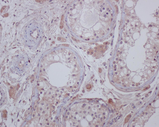 C19orf35 Antibody in Immunohistochemistry (Paraffin) (IHC (P))