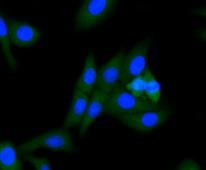 ALDH2 Antibody in Immunocytochemistry (ICC/IF)