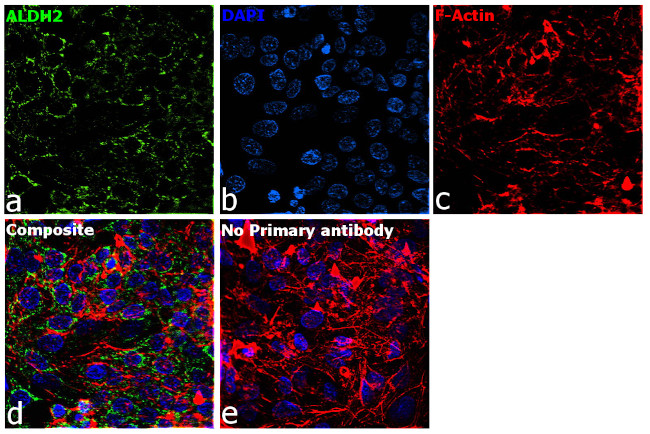 ALDH2 Antibody in Immunocytochemistry (ICC/IF)