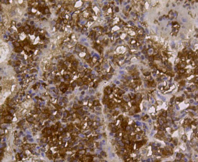 ALDH2 Antibody in Immunohistochemistry (Paraffin) (IHC (P))