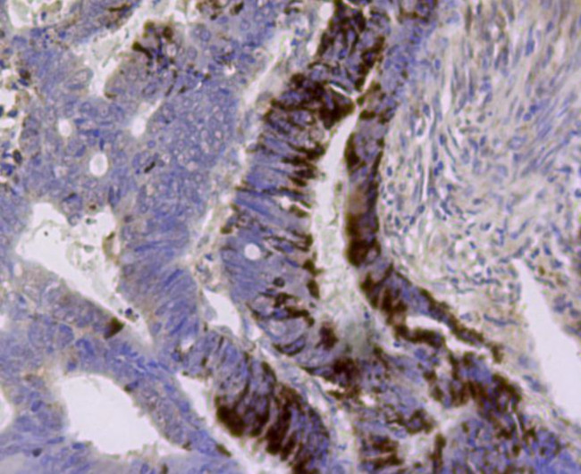 ALDH2 Antibody in Immunohistochemistry (Paraffin) (IHC (P))