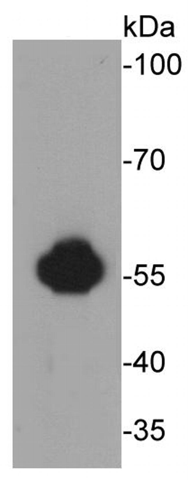 ALDH2 Antibody in Western Blot (WB)