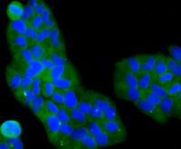 PI3K p85 alpha Antibody in Immunocytochemistry (ICC/IF)