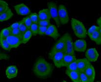 PI3K p85 alpha Antibody in Immunocytochemistry (ICC/IF)