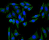 PI3K p85 alpha Antibody in Immunocytochemistry (ICC/IF)