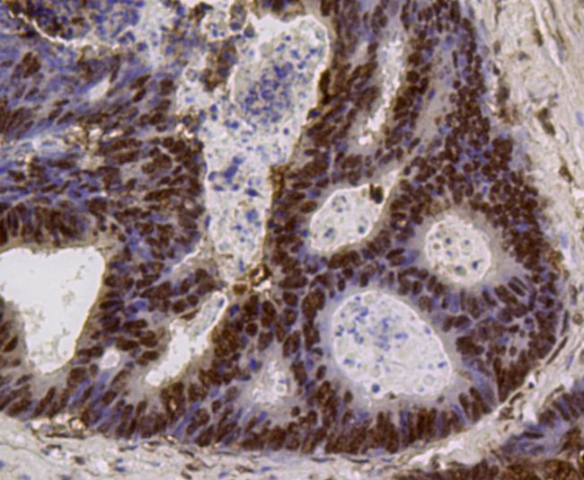 PI3K p85 alpha Antibody in Immunohistochemistry (Paraffin) (IHC (P))