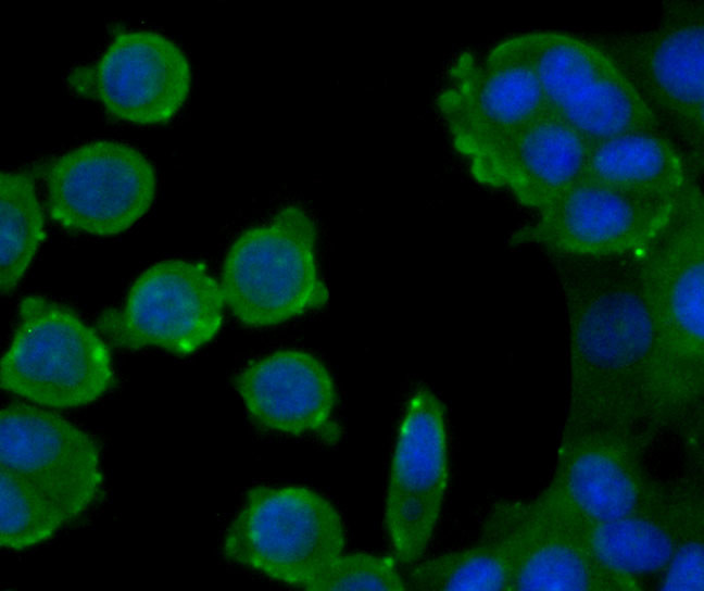 ATG12 Antibody in Immunocytochemistry (ICC/IF)