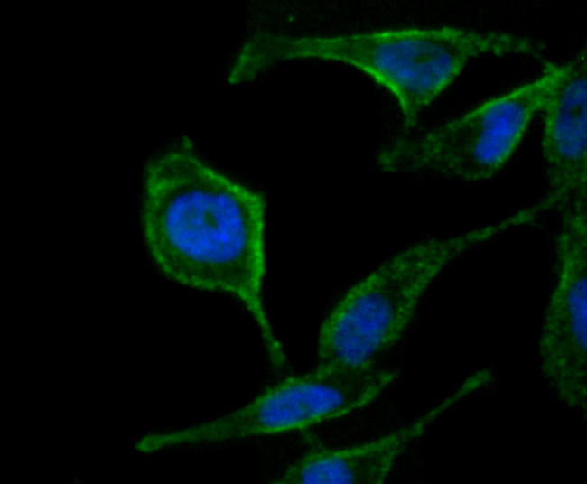 ATG12 Antibody in Immunocytochemistry (ICC/IF)