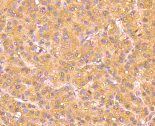 ATG12 Antibody in Immunohistochemistry (Paraffin) (IHC (P))