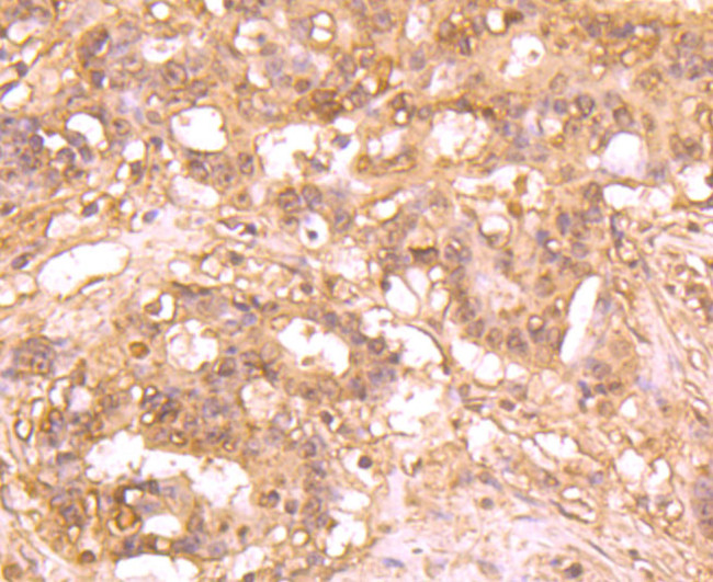 ATG12 Antibody in Immunohistochemistry (Paraffin) (IHC (P))