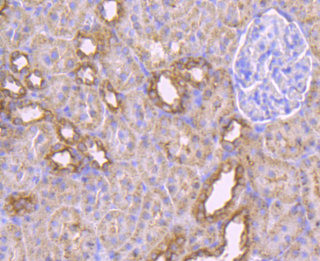 MAL Antibody in Immunohistochemistry (Paraffin) (IHC (P))